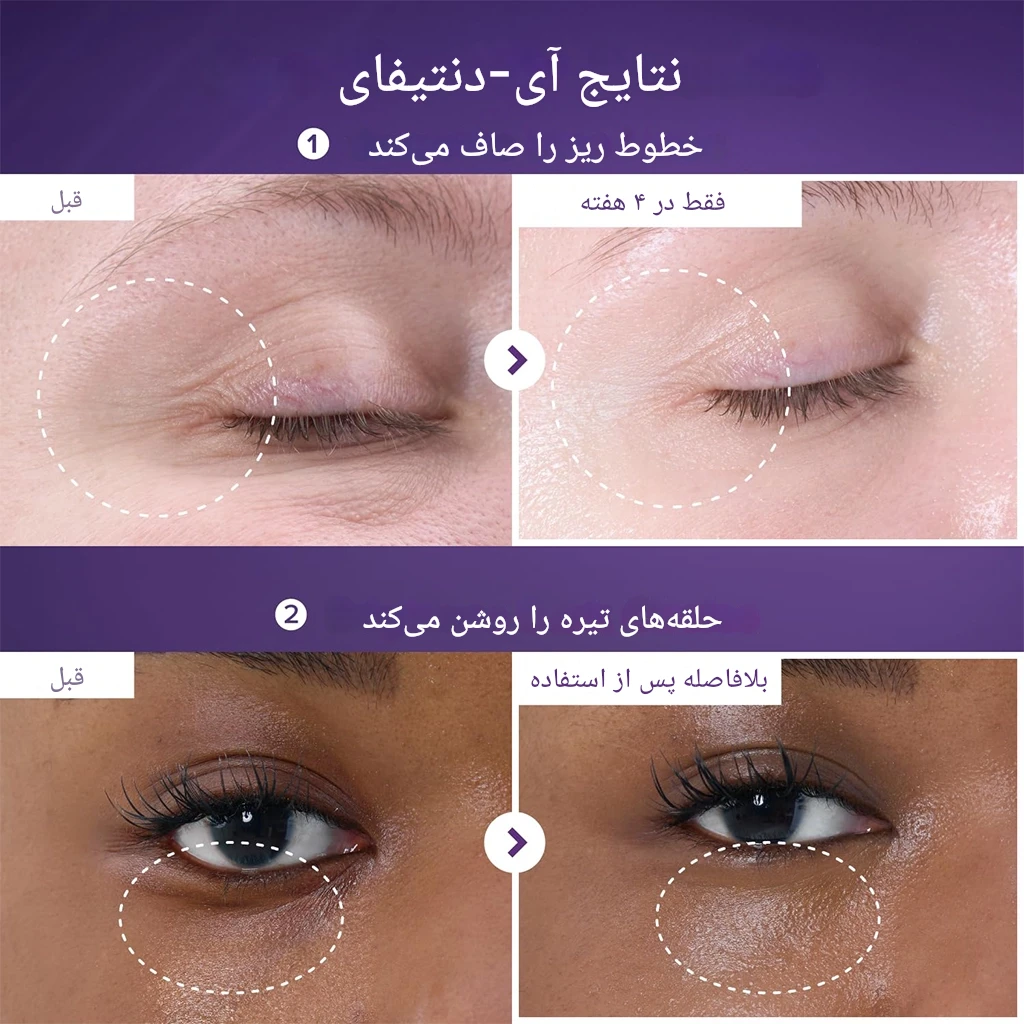 کرم دور چشم نامبوزین شماره 9 با ترکیب رتینول و NAD+